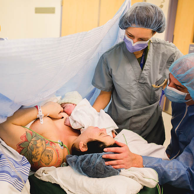 A gentler c-section