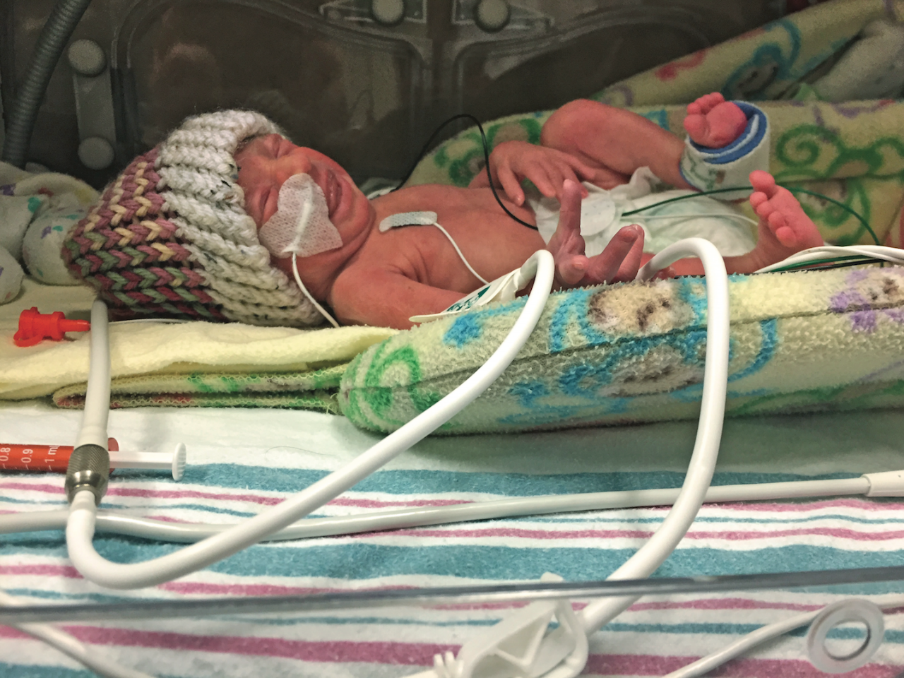 Close up shot of baby in an incubator in the NICU