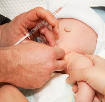 Rochdale Baby Circumcision
