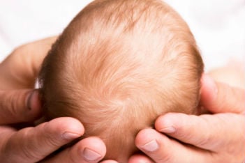 What you need to know about newborn cradle cap