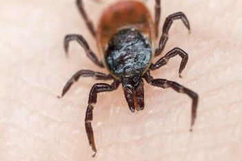 Ticks: 6 things your child needs for proper protection