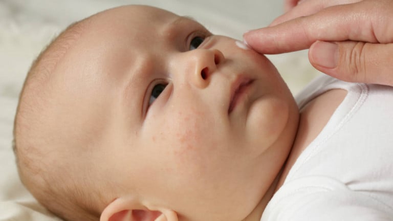 Rashes In Kids An Age By Age Guide To Children S Skin Conditions