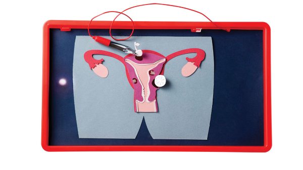 Paper illustration of uterine fibroids