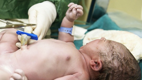 cutting baby's umbilical cord