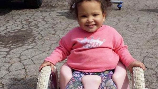 Girl with spinal bifida in bella bumbas wheelchair