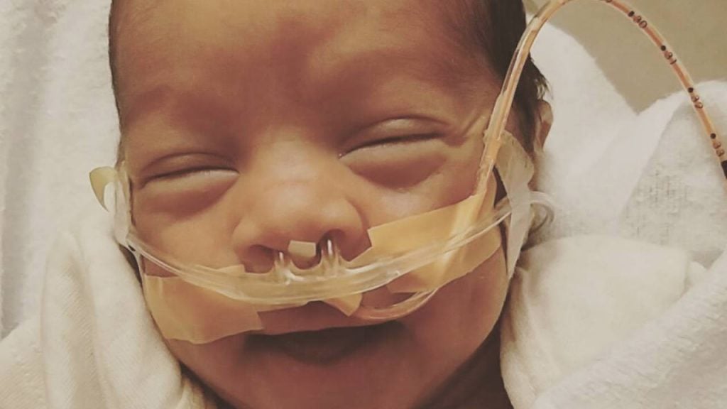 A smiling baby with a breathing tube in his nose
