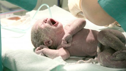 Picture of a newborn baby freshly out of the womb, laying down on the doctors table while they prepare to clean the baby