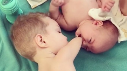 Toddler without hands soothes baby brother with a pacifier