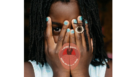 girl holding her hands over her face with an illustration of a mouth with tonsils drawn over her hands