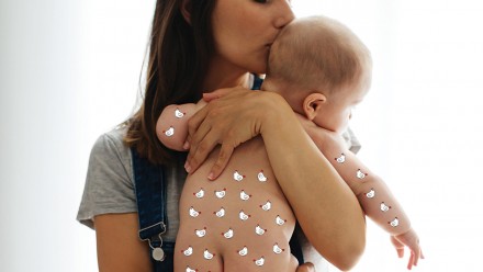 mother kissing her baby's head, baby has small chickens drawn over him to illustrate chicken pox