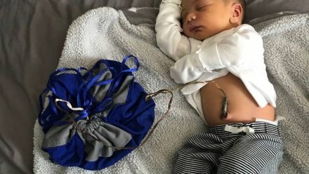 This mom had a lotus birth and you've gotta see her cute placenta bag