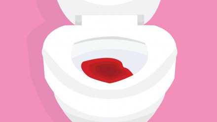 Illustration of blood in toilet.