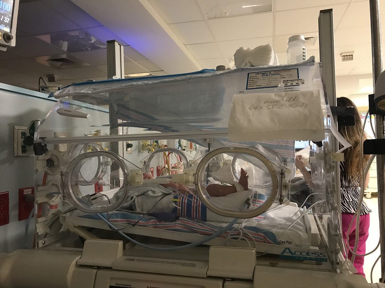 Photo of a premature baby boy in an incubator in the NICU