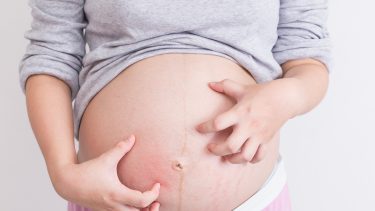 A pregnant woman scratching her belly