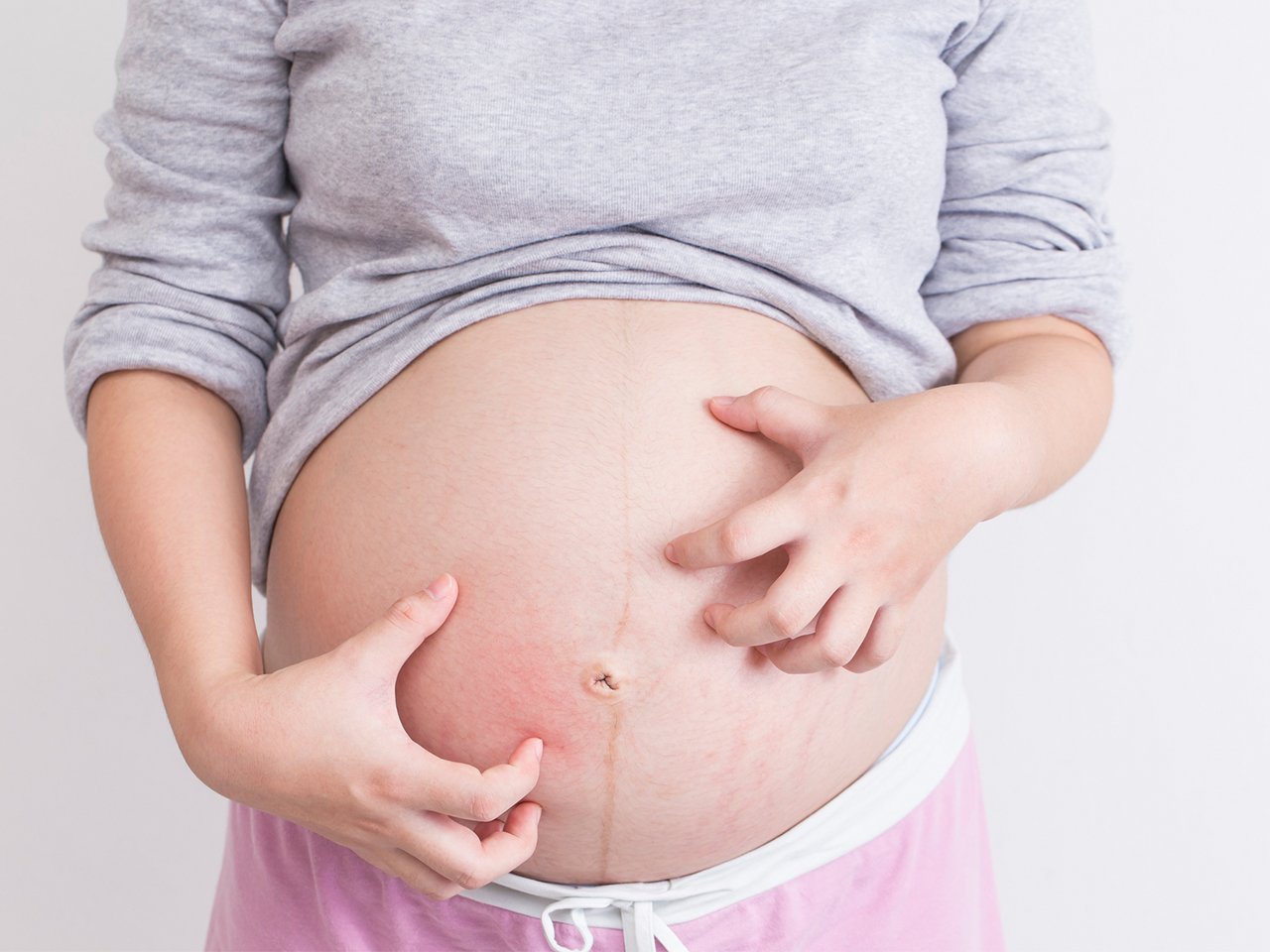 The Difference Between An Itchy Belly And Obstetric Cholestasis