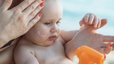 4 best ways to treat baby heat rash