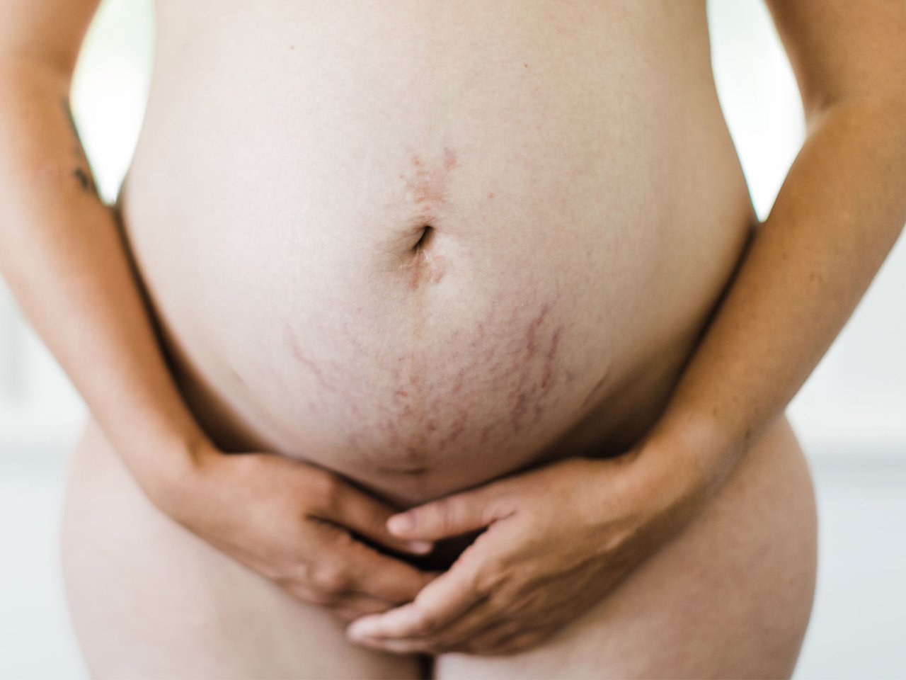 Verified Discount Online Coupon Stretch Marks 2020