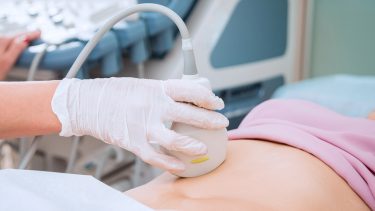 technician holding an ultrasound device over a women's stomach
