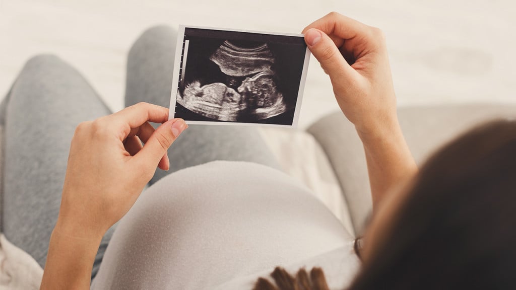How many ultrasounds do you get in a typical pregnancy?
