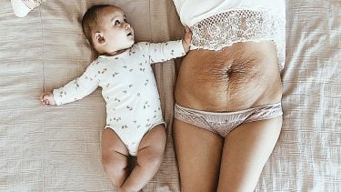 Woman showing of her postpartum belly