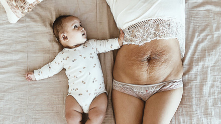 Woman showing of her postpartum belly