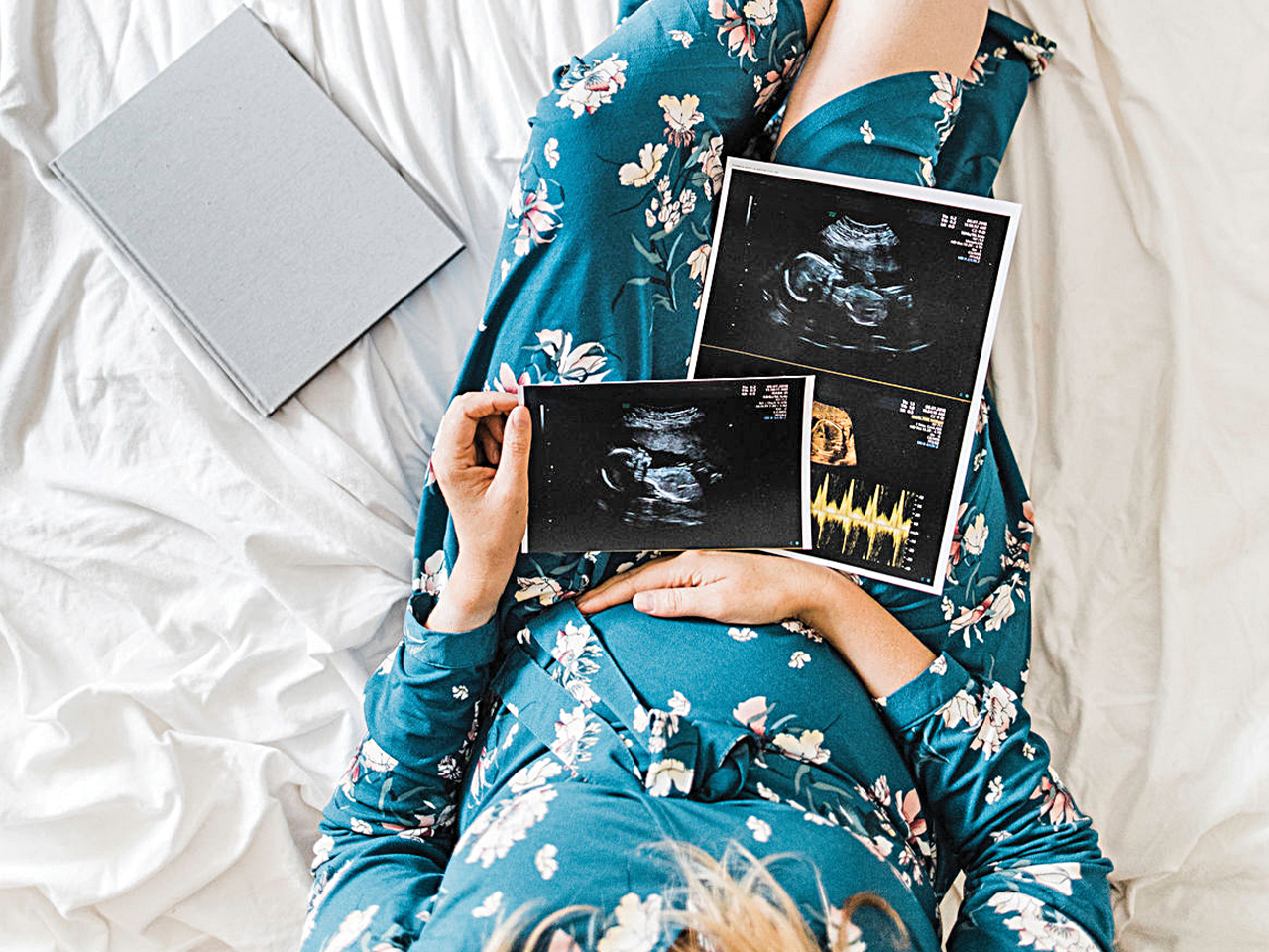 How many ultrasounds do you get in a typical pregnancy?