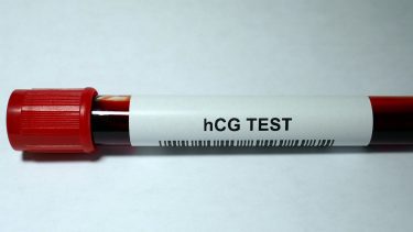 hCG levels: Vial of blood sample