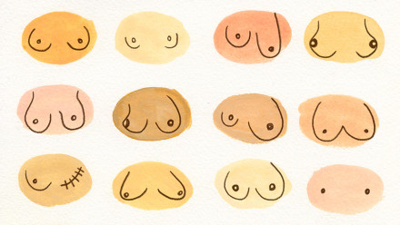 illustration of different types of breasts