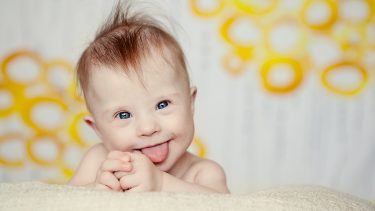 Cheerful baby girl with Down Syndrome