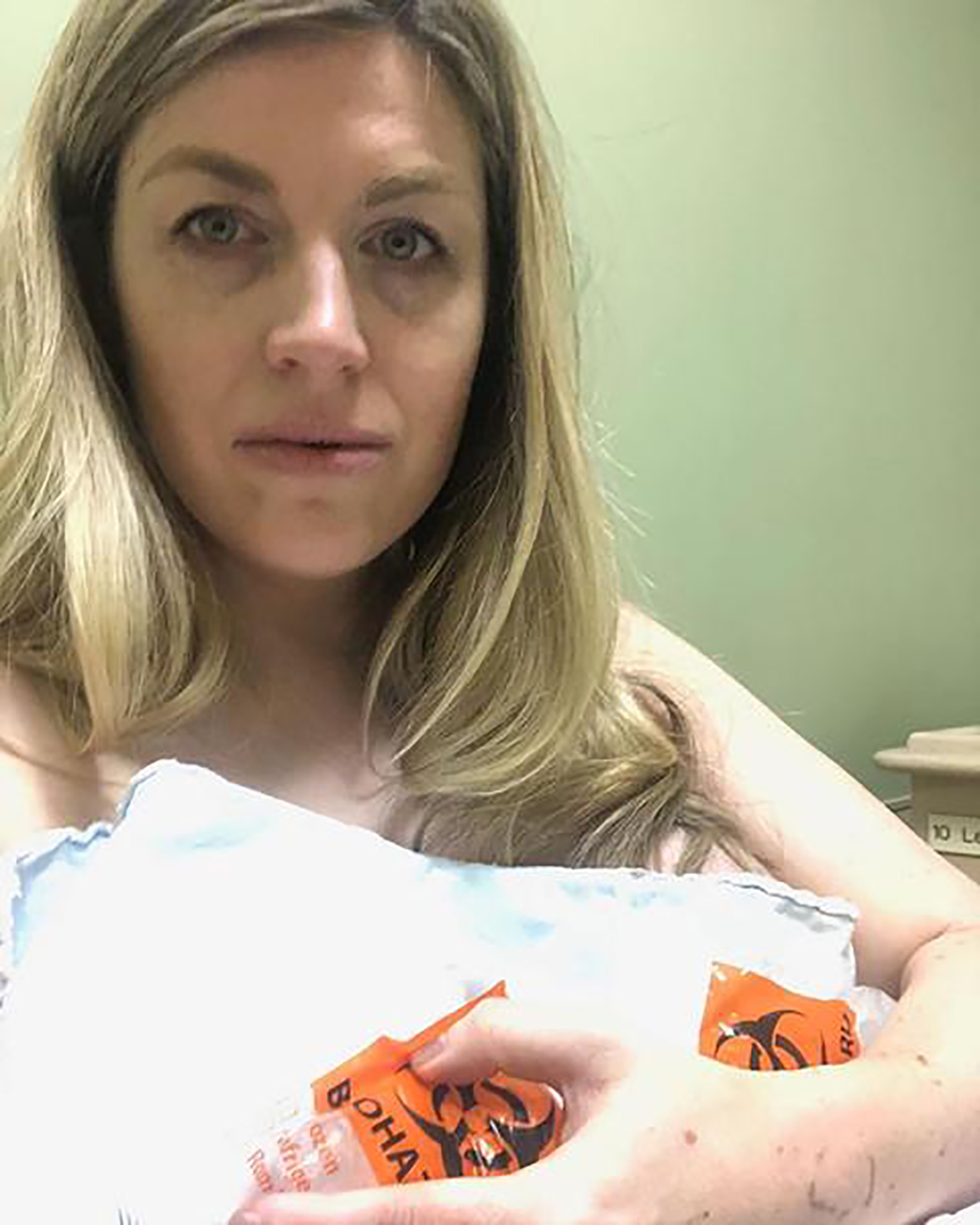 A woman in the hospital looks at the camera after giving birth and holds ice packs on her breasts