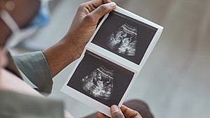 A person holds some ultrasound images